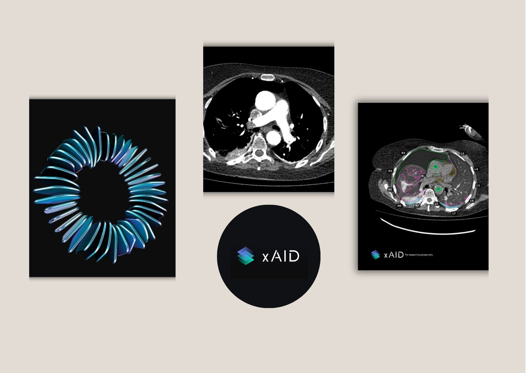 Practical Workflow for AI in Radiology Reporting and QA Practical Workflow for AI in Radiology Reporting and QA